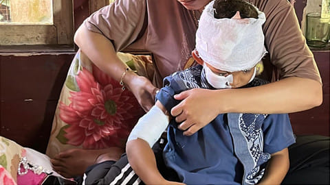 Serangan Monyet Liar di Cianjur: Anak 5 Tahun Jadi Korban Terbaru